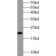 WB analysis of PC-3 cells, using CAV1 antibody (1/1000 dilution).