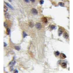 Protein CBFA2T2 (CBFA2T2) Antibody