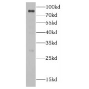 abx231315