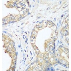 E3 Ubiquitin-Protein Ligase CBL (CBL) Antibody