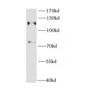 WB analysis of MCF7 cells, using CBL antibody (1/1000 dilution).