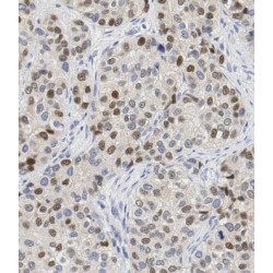 E3 Ubiquitin-Protein Ligase Hakai (CBLL1) Antibody