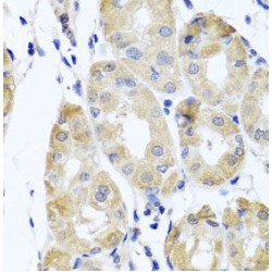 Carbonyl Reductase Family Member 4 (CBR4) Antibody