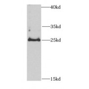 WB analysis of BxPC-3 cells, using CBR4 antibody (1/1000 dilution).