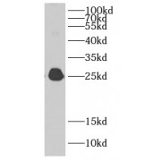 WB analysis of HEK-293 cells, using CBX1 antibody (1/1000 dilution).