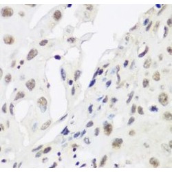 Chromobox Protein Homolog 3 (CBX3) Antibody