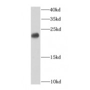 WB analysis of HeLa cells, using CBX3 antibody (1/1000 dilution).