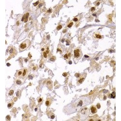 Chromobox Protein Homolog 5 (CBX5) Antibody