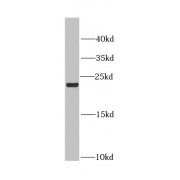 WB analysis of HeLa cells, using CBX5 antibody (1/1000 dilution).