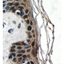 Chromobox Protein Homolog 6 (CBX6) Antibody