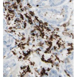Coiled-Coil Domain Containing 153 (CCDC153) Antibody