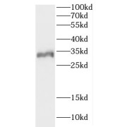 WB analysis of human skeletal muscle tissue, using CCDC28B antibody (1/300 dilution).