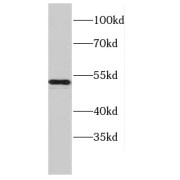 WB analysis of MCF7 cells, using CCDC6 antibody (1/500 dilution).