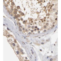 Coiled-Coil Domain Containing 62 (CCDC62) Antibody
