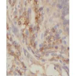 Coiled-Coil Domain Containing 93 (CCDC93) Antibody