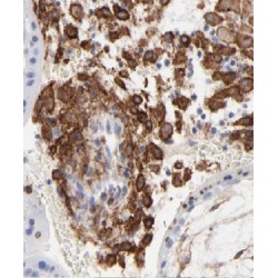 Coiled-Coil Domain Containing 94 (CCDC94) Antibody