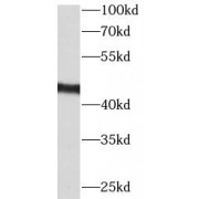 WB analysis of A431 cells, using CCRL2 antibody (1/1000 dilution).