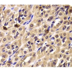 T-Complex Protein 1 Subunit Delta (CCT4) Antibody