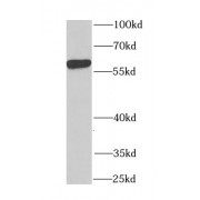 WB analysis of HeLa cells, using CCT4 antibody (1/1000 dilution).