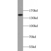 WB analysis of HL-60 cells, using CD11B/Integrin alpha M antibody (1/600 dilution).