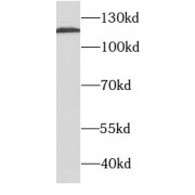 WB analysis of BxPC-3 cells, using CD138/Syndecan-1 antibody (1/400 dilution).