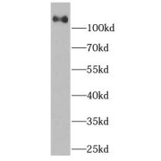 abx231425