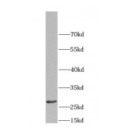 WB analysis of mouse liver tissue, using CD151 antibody (1/1000 dilution).