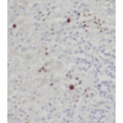 Cluster of Differentiation 40 Ligand / TNFSF5 (CD40LG) Antibody