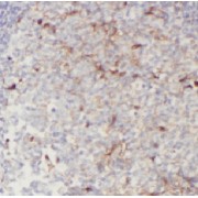 IHC-P analysis of human tonsillitis tissue, using CD244 Antibody (1/100 dilution).