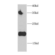 WB analysis of Jurkat cells, using CD3D antibody (1/1000 dilution).