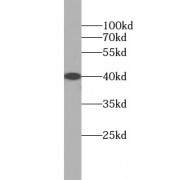 WB analysis of HL-60 cells, using CD38 antibody (1/1000 dilution).