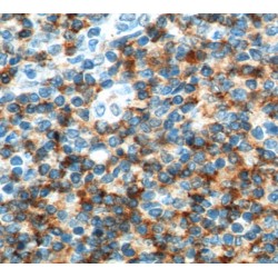 T-Cell Surface Glycoprotein CD4 (CD4) Antibody