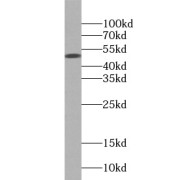 WB analysis of human spleen tissue, using CD4 antibody (1/1000 dilution).