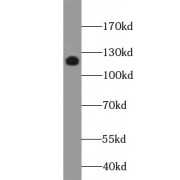 WB analysis of human blood tissue, using ITGA2B antibody (1/3000 dilution).