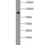 WB analysis of HeLa cells, using CD44 antibody (1/1000 dilution).