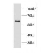 WB analysis of BxPC-3 cells, using CD69 antibody (1/2000 dilution).