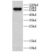 WB analysis of Human peripheral blood leukocyte cells, using CD80 antibody (1/300 dilution).