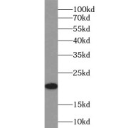 abx231501