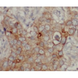 CD9 Antigen (CD9) Antibody