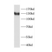 WB analysis of HeLa cells, using CDAN1 antibody (1/500 dilution).