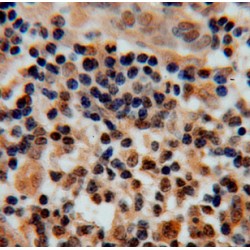 Cell Division Cycle Protein 16 Homolog / APC6 (CDC16) Antibody
