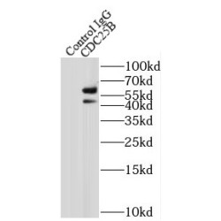 Cell Division Cycle 25B (CDC25B) Antibody