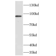 WB analysis of K-562 cells, using CDC27; APC3 antibody (1/600 dilution).