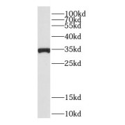 WB analysis of human pancreas tissue, using CDC34 antibody (1/300 dilution).