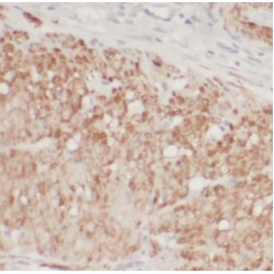Cell Division Cycle 6 (CDC6) Antibody