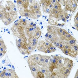 Cadherin Related 23 (CDH23) Antibody