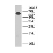 WB analysis of A172 cells, using CDH23 antibody (1/1000 dilution).