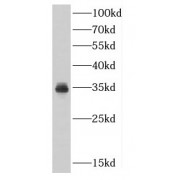 WB analysis of HepG2 cells, using CDK5 antibody (1/1000 dilution).