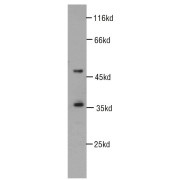 WB analysis of Jurkat cells, using CDK6 antibody (1/1000 dilution).