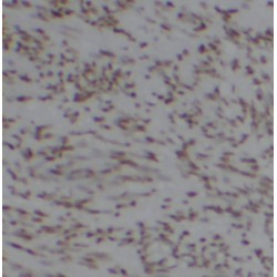 Cyclin Dependent Kinase 8 (CDK8) Antibody